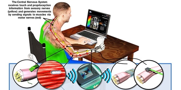 DARPA Two-Way Neural Interface