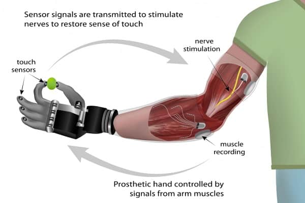 DARPA's Hybrid Neural Interface for Bionic Hands