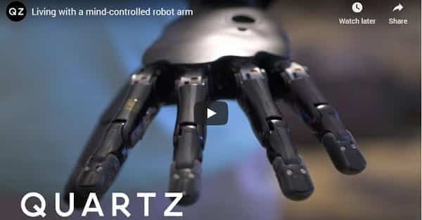 Living With A Mind-Controlled Robot Arm