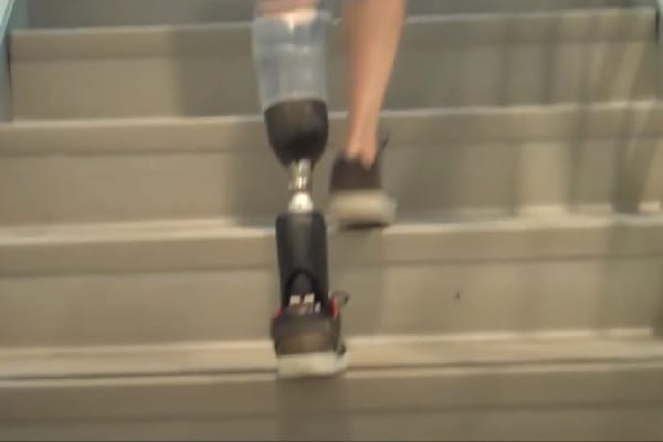 Bionic Feats Conquering Stairs Feature Image