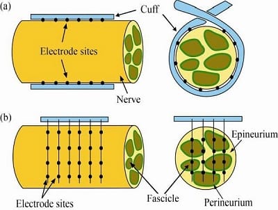 Peripheral Nerve Cuff Electrode