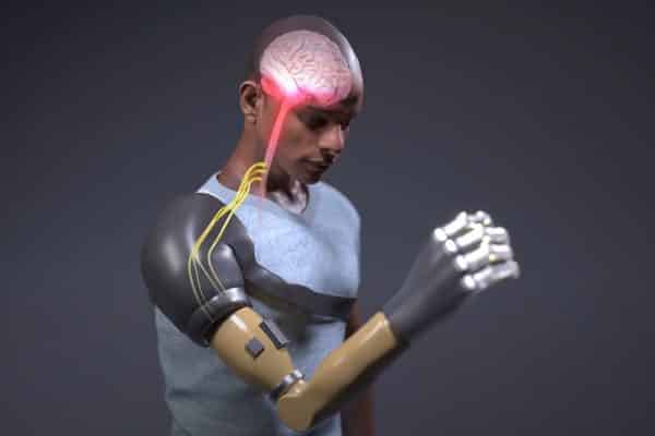 A Complete Guide to Bionic Arms & Hands | Bionics For Everyone